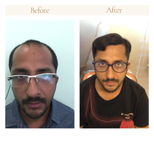 neutral before and after instagram post 2.png