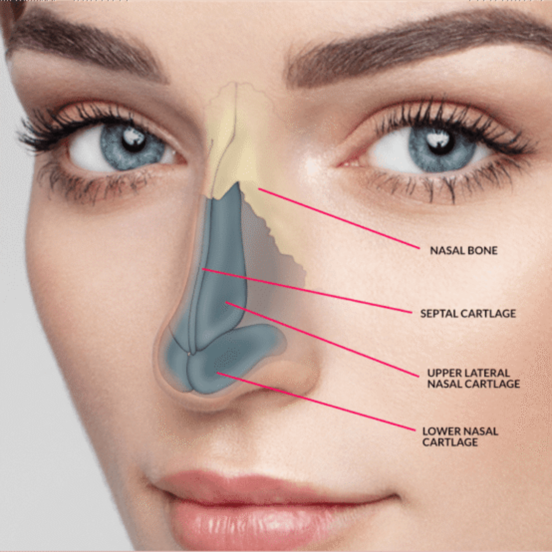 Rhinoplasty