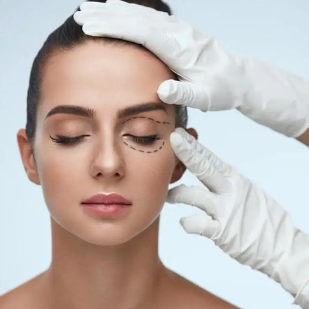 Blepharoplasty