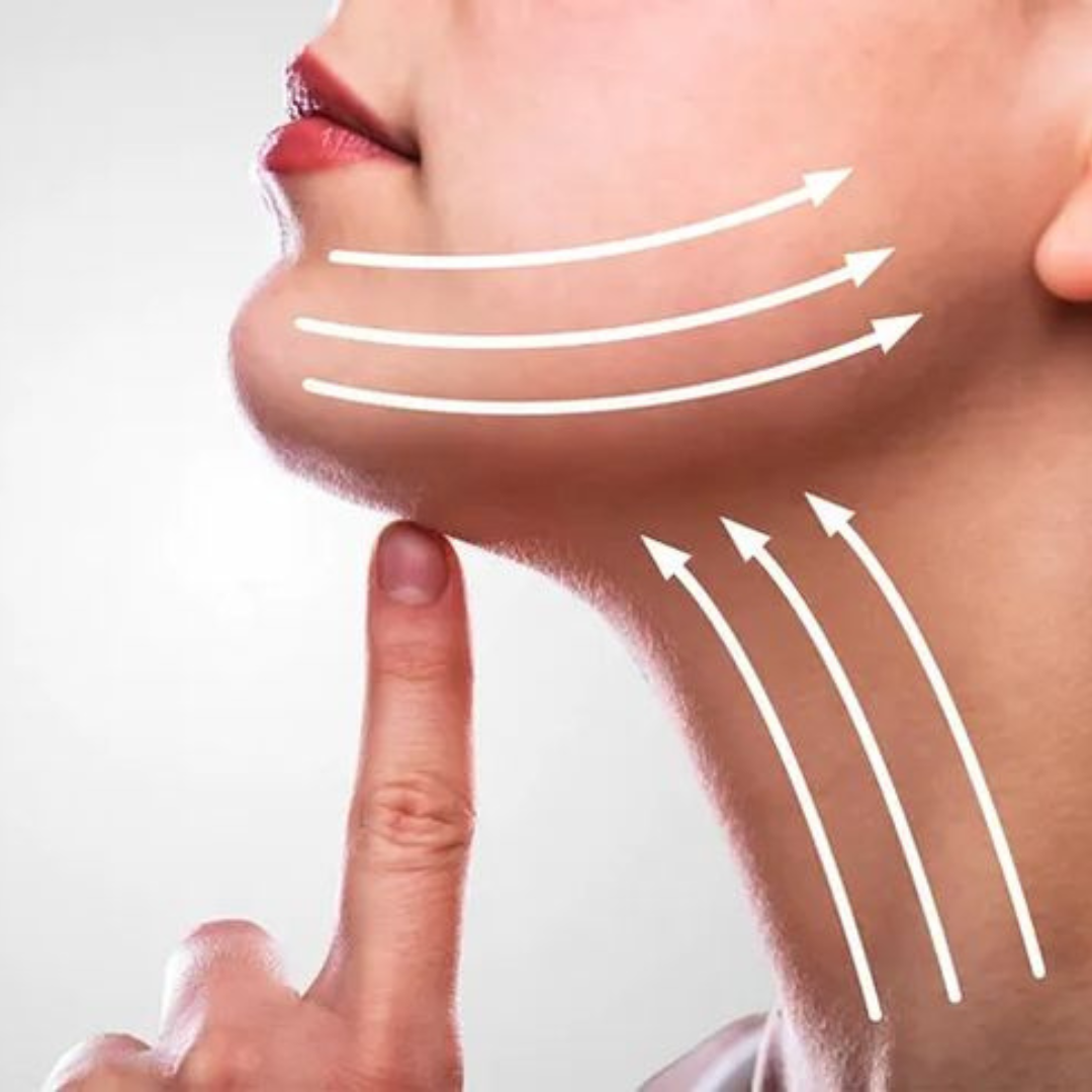 Neck Lift