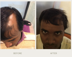 green gentle before and after instagram post