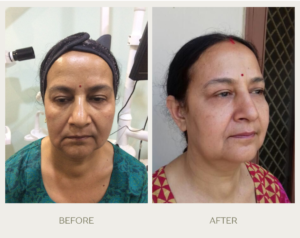 green gentle before and after instagram post (4)