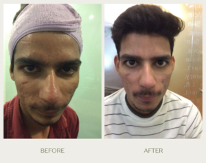 green gentle before and after instagram post (5)