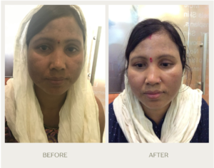 green gentle before and after instagram post (6)d